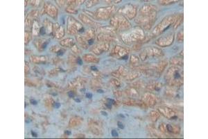 Used in DAB staining on fromalin fixed paraffin- embedded kidney tissue (Neudesin 抗体  (AA 32-172))