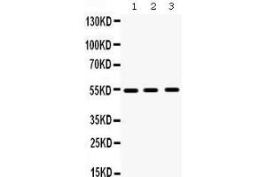Western Blotting (WB) image for anti-Matrix Metallopeptidase 10 (Stromelysin 2) (MMP10) (AA 409-443), (C-Term) antibody (ABIN3043406) (MMP10 抗体  (C-Term))