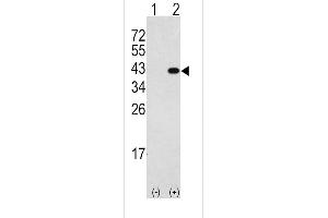 Western blot analysis of DK2(arrow) using rabbit polyclonal DK2 Antibody (N-term) 7218a. (DAPK2 抗体  (N-Term))