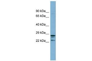 CUTC antibody used at 1 ug/ml to detect target protein.