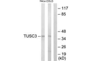 Western blot analysis of extracts from COLO205/HeLa cells, using TUSC3 Antibody. (TUSC3 抗体  (AA 131-180))