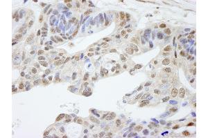 Immunohistochemistry (IHC) image for anti-Uveal Autoantigen With Coiled Coil Domains And Ankyrin Repeats (UACA) (AA 675-725) antibody (ABIN7448846)