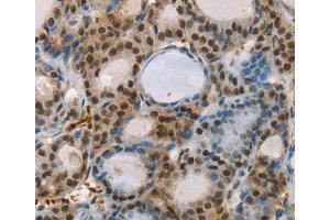 Immunohistochemistry (IHC) image for anti-Runt-Related Transcription Factor 1, Translocated To, 1 (Cyclin D-Related) (RUNX1T1) antibody (ABIN2427103) (RUNX1T1 抗体)