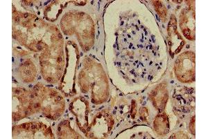 Immunohistochemistry of paraffin-embedded human kidney tissue using ABIN7167943 at dilution of 1:100 (ARHGAP25 抗体  (AA 17-280))