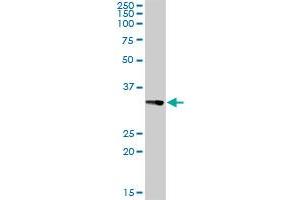 CENPH MaxPab rabbit polyclonal antibody. (CENPH 抗体  (AA 1-247))