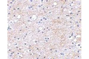 Immunohistochemical staining of human brain tissue using LGI1 polyclonal antibody  at 2. (LGI1 抗体  (Internal Region))