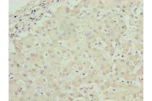 Immunohistochemistry of paraffin-embedded human liver tissue using ABIN7142833 at dilution of 1:100 (RPL7L1 抗体  (AA 1-246))