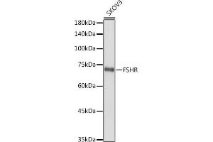 Western blot analysis of extracts of SKOV3 cells, using FSHR antibody (ABIN3022001, ABIN3022002, ABIN3022003, ABIN1512927 and ABIN6218564) at 1:1000 dilution. (FSHR 抗体  (AA 631-695))