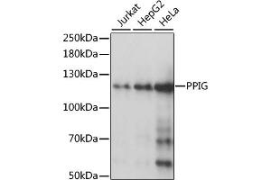 Western blot analysis of extracts of various cell lines, using PPIG antibody (ABIN1513403, ABIN3020977, ABIN3020978 and ABIN6213843) at 1:1000 dilution. (PPIG 抗体  (AA 1-100))