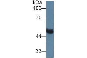Rabbit Capture antibody from the kit in WB with Positive Control:  Rat serum. (MMP13 ELISA 试剂盒)