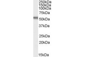 Image no. 1 for anti-Early Growth Response 2 (EGR2) (Internal Region) antibody (ABIN375194) (EGR2 抗体  (Internal Region))