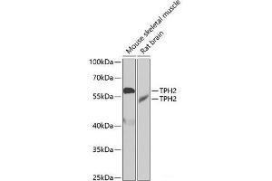 Western blot analysis of extracts of various cell lines using TPH2 Polyclonal Antibody at dilution of 1:1000. (Tryptophan Hydroxylase 2 抗体)