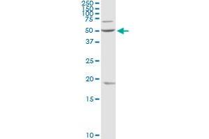 OXCT1 MaxPab rabbit polyclonal antibody. (OXCT1 抗体  (AA 1-520))