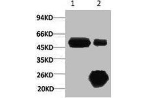 1) Input: Hela Cell Lysate 2) IP product: IP dilute 1:200 (KRT17 抗体)