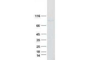 Western Blotting (WB) image for HECT Domain Containing 2 (HECTD2) (Transcript Variant 1) protein (Myc-DYKDDDDK Tag) (ABIN2722579)