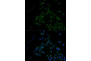Immunofluorescence analysis of A549 cell using ARF6 antibody. (ARF6 抗体)