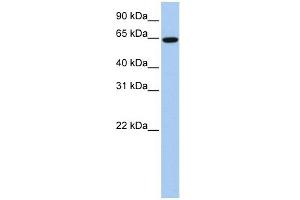 EPS8L1 antibody used at 1 ug/ml to detect target protein. (EPS8-Like 1 抗体  (Middle Region))