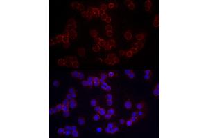 Immunofluorescence analysis of Raji cells using CD86 Rabbit pAb (ABIN3021700, ABIN3021701, ABIN3021702, ABIN1512724 and ABIN6215549) at dilution of 1:200 (40x lens). (CD86 抗体  (AA 30-247))