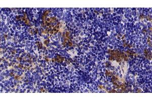 Detection of S100A8 in Mouse Spleen Tissue using Polyclonal Antibody to S100 Calcium Binding Protein A8 (S100A8) (S100A8 抗体  (AA 1-89))