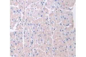 IHC-P analysis of Mouse Tissue, with DAB staining. (BMP10 抗体  (AA 314-421))