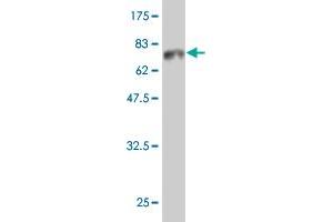 Western Blot detection against Immunogen (66. (HDAC8 抗体  (AA 1-377))