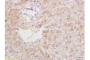 Formalin-fixed and paraffin embedded rat liver tissue with Anti-Resistin Polyclonal Antibody, Unconjugated  at 1:400, followed by conjugation to the secondary antibody and DAB staining (Resistin 抗体  (AA 21-114))