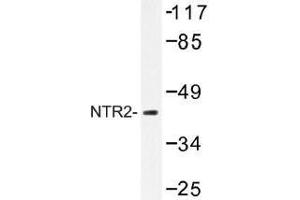 Image no. 1 for anti-Neurotensin Receptor 2 (NTSR2) antibody (ABIN317761) (NTSR2 抗体)