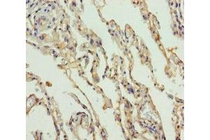 Immunohistochemistry of paraffin-embedded human lung tissue using ABIN7169988 at dilution of 1:100 (Solute Carrier Family 34 (Type II Sodium/phosphate Contransporter), Member 1 (SLC34A1) (AA 1-103) 抗体)