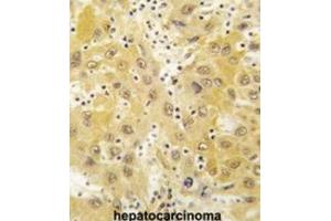 Immunohistochemistry (IHC) image for anti-TCDD-Inducible Poly(ADP-Ribose) Polymerase (Tiparp) antibody (ABIN3003615) (Tiparp 抗体)