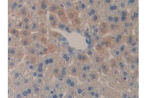 Detection of DLD in Mouse Liver Tissue using Polyclonal Antibody to Dihydrolipoyl Dehydrogenase (DLD) (DLD 抗体  (AA 45-271))