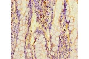 Immunohistochemistry of paraffin-embedded human small intestine tissue using ABIN7143485 at dilution of 1:100 (ARL15 抗体  (AA 1-204))