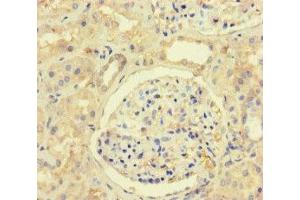 Immunohistochemistry of paraffin-embedded human kidney tissue using ABIN7150201 at dilution of 1:100 (MLH1 抗体  (AA 350-519))