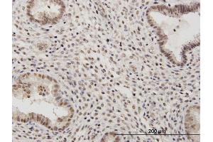 Immunoperoxidase of purified MaxPab antibody to RSC1A1 on formalin-fixed paraffin-embedded human endometrium. (RSC1A1 抗体  (AA 1-617))
