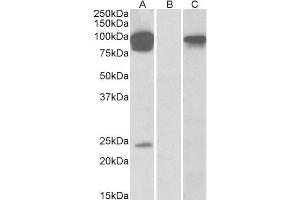 HEK293 lysate (10ug protein in RIPA buffer) overexpressing Human TRPV3 with DYKDDDDK tag probed with ABIN570683 (0. (TRPV3 抗体  (AA 762-773))