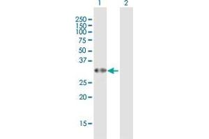 Western Blot analysis of C6orf206 expression in transfected 293T cell line by C6orf206 MaxPab polyclonal antibody. (RSPH9 抗体  (AA 1-276))