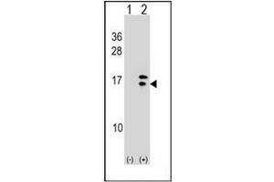 Western blot analysis of CRABP2 (arrow) using CRABP2 Antibody (C-term) Cat. (CRABP2 抗体  (C-Term))