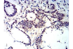 Immunohistochemistry (IHC) image for anti-B-Cell CLL/lymphoma 11B (Zinc Finger Protein) (BCL11B) (AA 1-150) antibody (ABIN5611301)