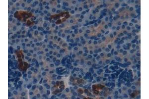 Immunohistochemistry (IHC) image for anti-S100 Calcium Binding Protein A8 (S100A8) (AA 1-89) antibody (ABIN7434065)
