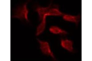 ABIN6266902 staining Hela by IF/ICC. (DGKH 抗体  (Internal Region))