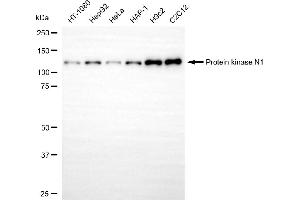 Western blotting analysis using protein kinase N1 antibody (ABIN7800005). (Recombinant PKN1 抗体)