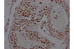 IHC image of ABIN7127590 diluted at 1:100 and staining in paraffin-embedded human testis tissue performed on a Leica BondTM system. (Recombinant LSD1 抗体)