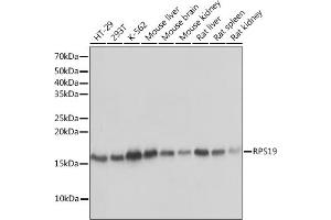 Western blot analysis of extracts of various cell lines, using RPS19 Rabbit mAb (ABIN1681275, ABIN3017969, ABIN3017970 and ABIN7101552) at 1:1000 dilution. (RPS19 抗体)