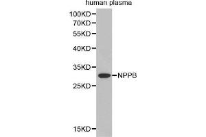 Western Blotting (WB) image for anti-Natriuretic Peptides B (NPPB) (AA 1-134) antibody (ABIN3023136) (NPPB 抗体  (AA 1-134))