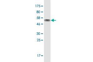 Western Blot detection against Immunogen (51. (ZNF511 抗体  (AA 20-252))