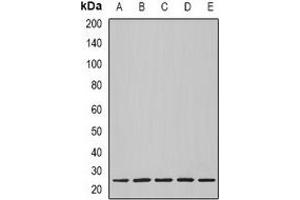 Western blot analysis of Nop30 expression in BT474 (A), MCF7 (B), mouse heart (C), mouse lung (D), rat heart (E) whole cell lysates. (NOL3 抗体)
