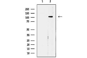 anti-Polymerase (RNA) I Polypeptide B, 128kDa (POLR1B) (Internal Region) antibody