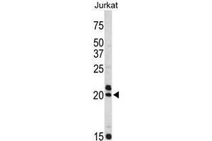 Western blot analysis of VIP antibody (C-term) in Jurkat cell line lysates (35ug/lane). (Vip 抗体  (C-Term))