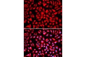 Immunofluorescence analysis of U2OS cells using IPO5 antibody. (Importin 5 抗体  (AA 20-300))