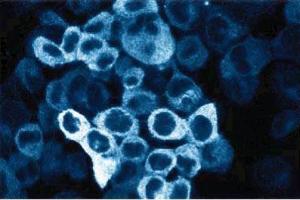 Immunofluorescent staining of A431 cells. (C-Raf-1 (AA 162-378) 抗体)