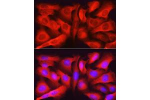 Immunofluorescence analysis of U2OS cells using ASNS Rabbit pAb (ABIN6127372, ABIN6137209, ABIN6137210 and ABIN6221207) at dilution of 1:50 (40x lens). (Asparagine Synthetase 抗体  (AA 262-561))